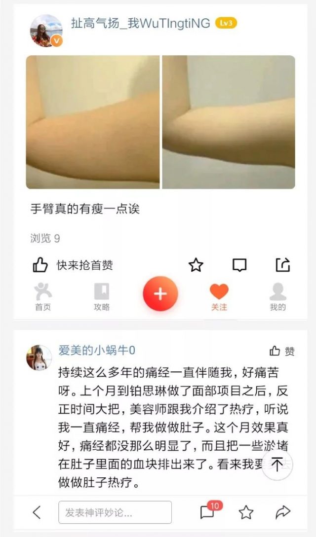 深部热疗真人案例