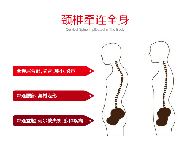 颈椎病牵连全身